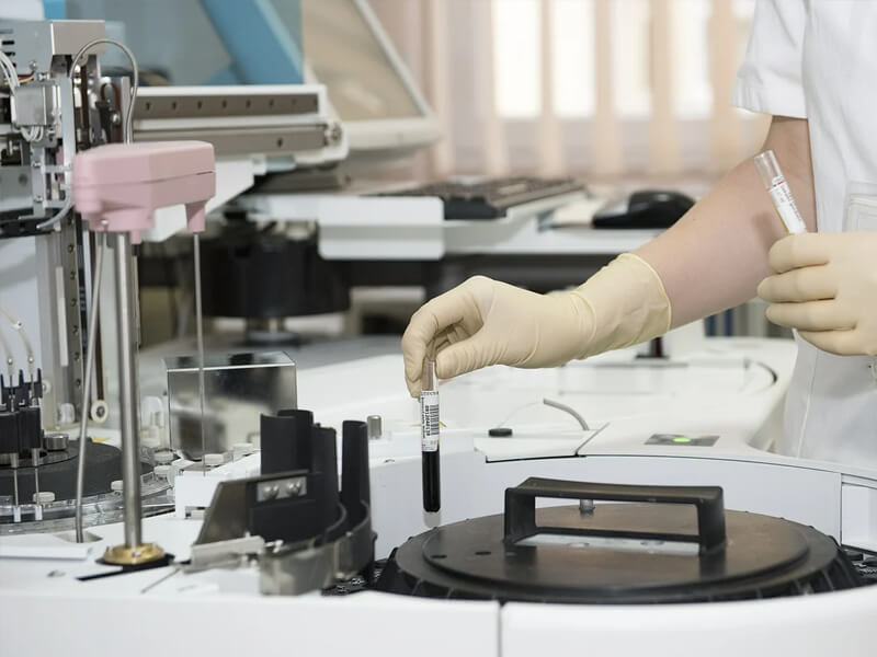 Lab Test